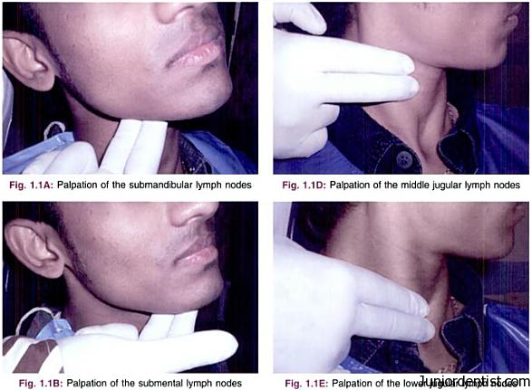 Examination of Head and Neck Lymph Nodes