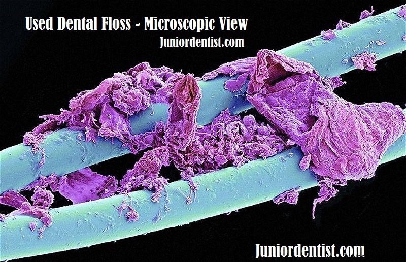 Rare Microscopic View of a Used Dental Floss