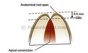 Cemento dentinal junction location for Apex locators
