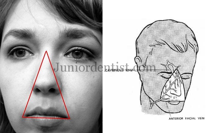 dangerous area of face or dangerous triangle of face