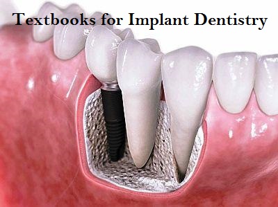 Textbooks for Dental Implantology