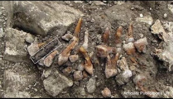 2300 year old dental implant found in france
