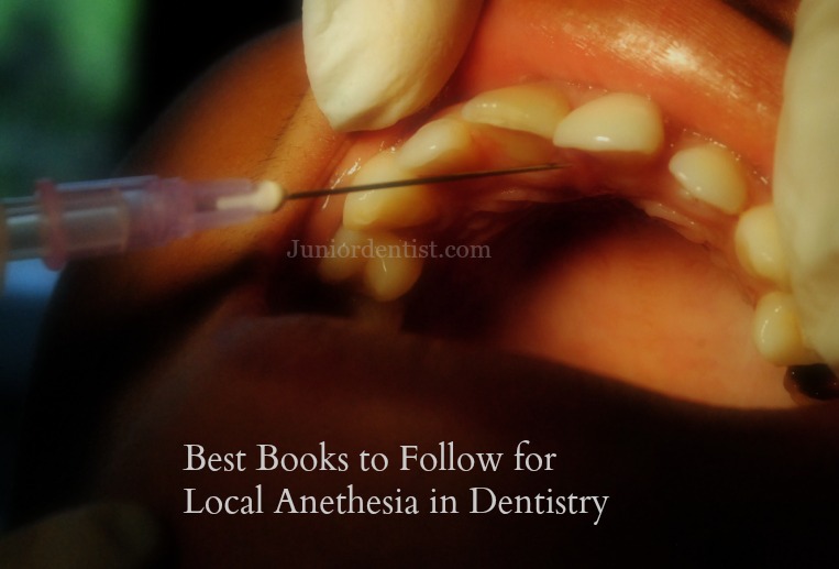 List of Books to follow for Local Anesthesia in Dentistry