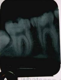 Radiographic faults in Dentistry