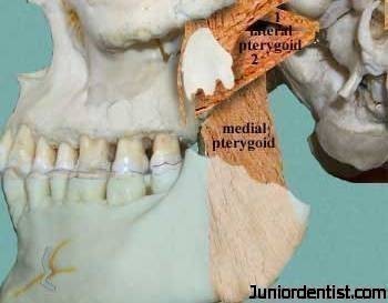 Lateral Pterygoid and medial pterygoid muscle.