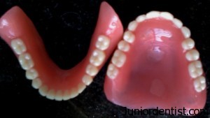 Relining and Rebasing of Complete denture