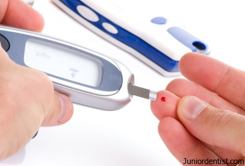 diabetes check up glucometer in dental treatment