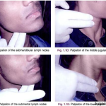 Examination of Head and Neck Lymph Nodes