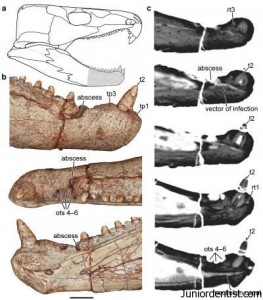 Oldest Tooth infection in Paleozoic reptile