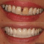 cosmetic dentistry treatment procedures