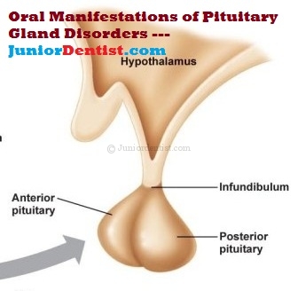 Oral manifestations of Pituitary disorders