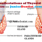 Oral manifestations of thyroid disorders - Hyper Thyroidism, Hypo Thyroidism and Hypo para Thyroidism