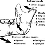 Favourable and unfavourabel fractures of mandible