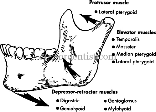 Favourable and unfavourabel fractures of mandible