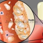 Micro organisms predominantly found in various parts of Oral cavity