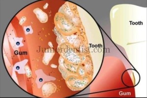 Micro organisms predominantly found in various parts of Oral cavity