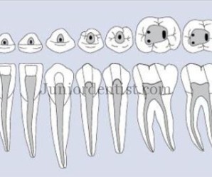 Mandibular access cavity shapes