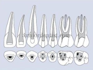 Maxillary teeth access Cavity Shapes