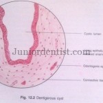 Histologic Features of Dentigerous Cyst