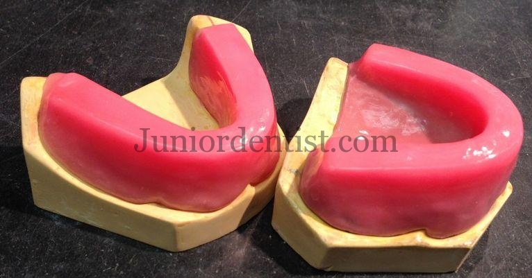 occlusal rims for recording Jaw relations