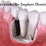 Textbooks for Dental Implantology