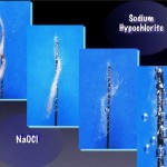 Action of Sodium Hypochlorite on Pulp Tissue