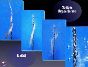 Action of Sodium Hypochlorite on Pulp Tissue