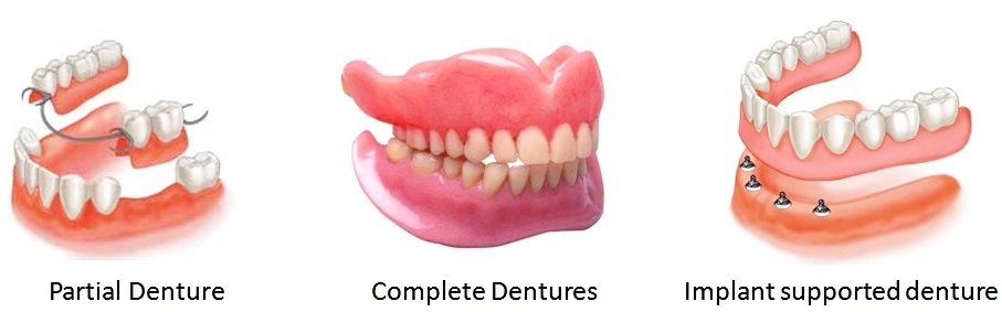 Are all Dentures created equal