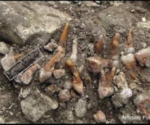2300 year old dental implant found in france