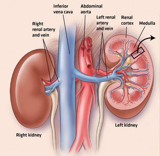 Periodontal disease related to chronic kidney disease