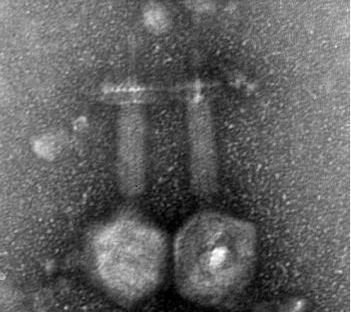 Bacteriophage found in sewage to fight against E feacalis