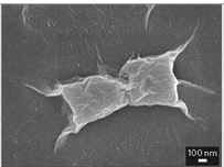 graphene oxide killing bacteria causing tooth decay and gum disease