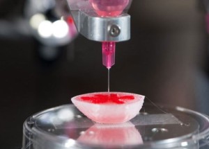 3D printing used to create periodontal scaffolds and help in craniofacial deformities