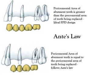Antes Law for FPDs in Prosthodontics