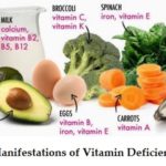 Oral manifestations of Vitamin deficiencies