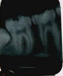 Radiographic faults in Dentistry