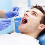 How are Dental points calculated for SSB medical health examination