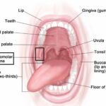 What is Retromolar Trigone – Anatomy, Boundaries and Importance