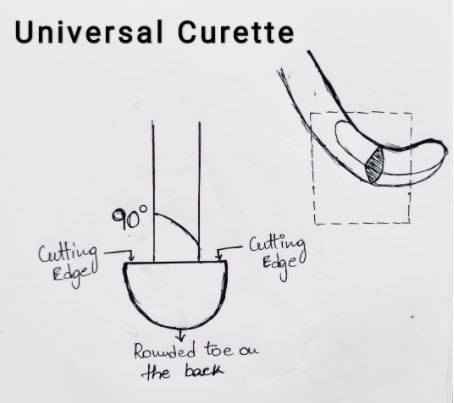 Universal Curette for Scaling and Root Planning