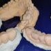 Classifications of Fixed Partial Dentures and Bridges