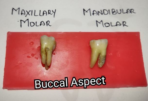 Differences between Maxillary and Mandibular Molars Buccal Aspect
