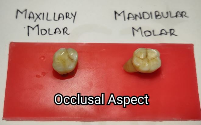 Differences between Maxillary and Mandibular Molars Occlusal