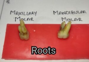 Differences between Maxillary and Mandibular Molars Roots