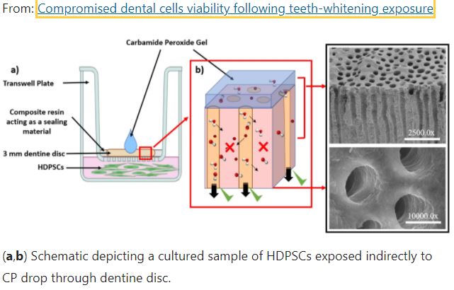 Harmful effects of home teeth whitening kits