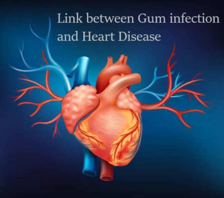 Link between Gum infection and Heart Disease