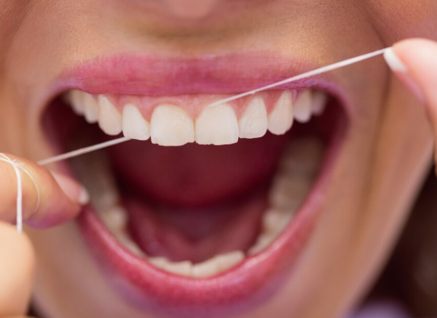 How to Floss under Permanent Retainers after Orthodontic treatment
